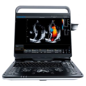 ULTRASONIDO CHISON EBIT 60