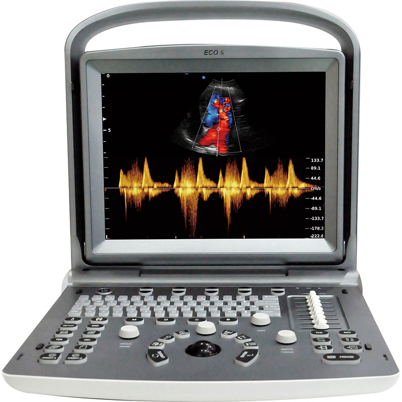 ULTRASONIDO CHISON ECO6